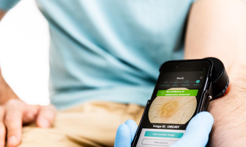 AI medical technology har utvecklat Dermayser, en applikation som används tillsammans med ett dermatoskop monterat framför en mobilkamera. AI medical technology har utvecklat Dermayser, en applikation som används tillsammans med ett dermatoskop monterat framför en mobilkamera.