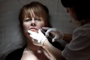 Hver fjerde dansker overvejer en kosmetisk operation