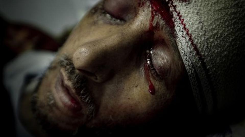Årets Pressefoto 2012: På et hospital i Tobruk ligger Hussein Saleh Hassan, 52 år, dødeligt såret. Han blev skudt i hovedet af Gaddafi-tro soldater, da han sammen med en gruppe mænd stormede den lokale politistation 17. februar 2011. Angrebet på politistationen var et af startskuddene til revolutionen i Libyen. (Foto: Mads Nissen/Scanpix 2012)