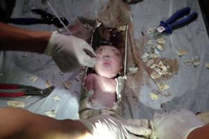 Nyfødt blev skyllet ud i toilettet