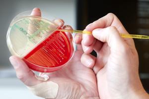 Ferie i udlandet: Her skal du passe på resistente bakterier