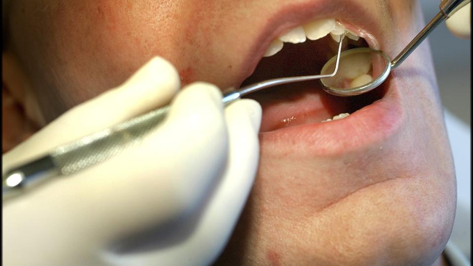 I mange tilfælde kan folk på lak på huller i tænderne og slippe bor boret. Arkivfoto <i>Pressefotograf Lars Pauli</i>