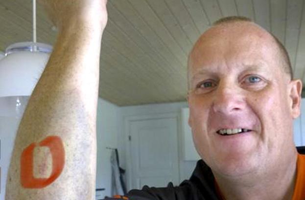 Dette billede blev taget et par dage efter, at Per Hakonsen styrtede på sin mountainbike. Privatfoto