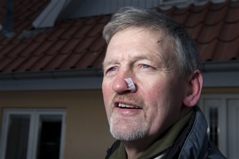 Niels Andreasen fik syet en flænge på næsen efter mødet med indbrudstyven. Foto: Henrik Louis.