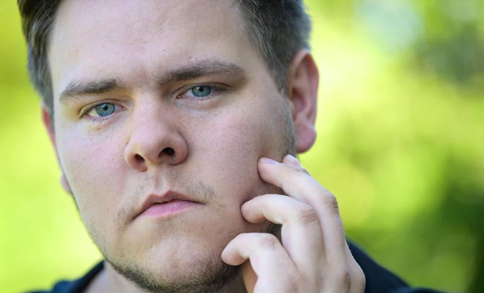Steven Brøndel deltager i et forskningsprojekt, som giver ham mulighed for at få erstattet en manglende tand i overkæben, men en planlagt operation endte med at blive udskudt i to måneder, fordi det ikke lykkedes at tage den påkrævede coronatest forud for operationen. Foto: Bo Lehm