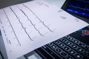 AAU-forsker trækker i land: - Sig trygt ja til pacemaker