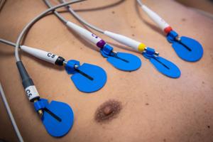 Nordjysk forskning afslører: En pacemaker kan være livsfarlig - se hvorfor