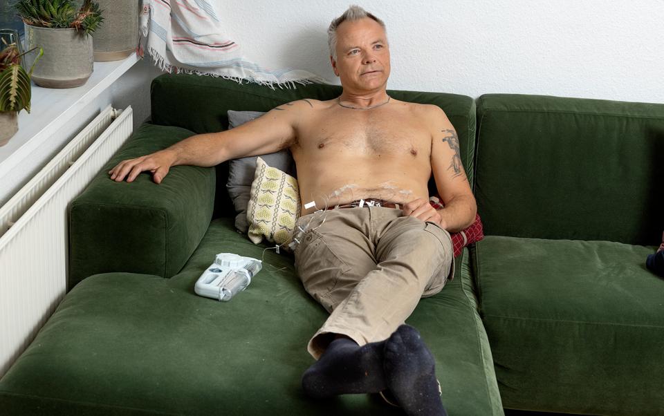 Tom Mejland behandles to gange om ugen. <i>Foto: Lars Pauli</i>