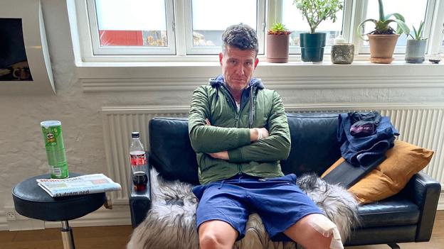 Søren Christensen i hjemmet efter at være udskrevet. Iført sine nyindkøbte shorts. Privatfoto