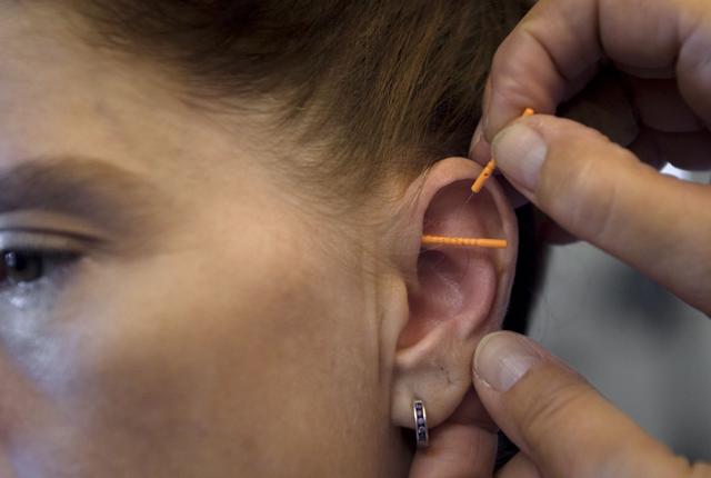 Fem nåle placeres på hvert øre - tre til de indre organer og to til psyken,