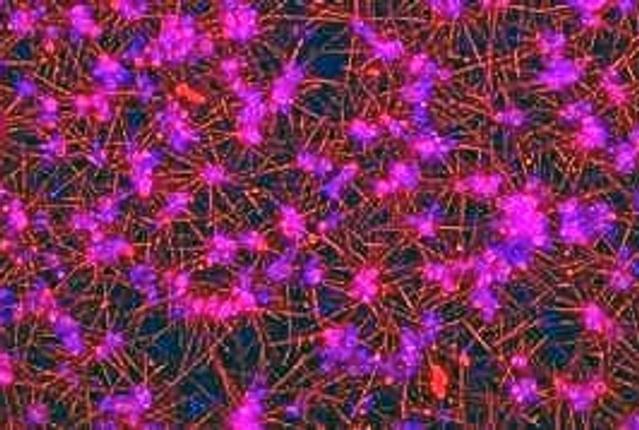 Bakterien Staphylococcus aureus har et særligt trick i ærmet når den danner biofilm: Cellerne (blå) udskiller et protein som får blodet til at koagulere, og cellerne sidder beskyttet i et netværk af fibrin (rødt). Foto: Natalia Zobel og Rikke Meyer