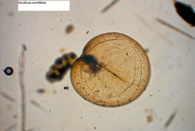 Her ses algen noctiluca scintillans, som typisk er 0,5-1 mm i diameter. Foto: Miljøstyrelsen