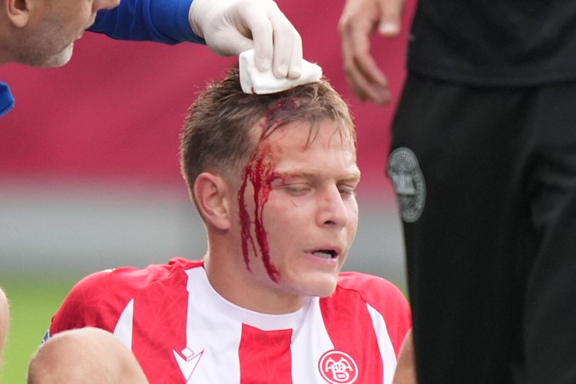 Det så voldsomt ud, men Mathias Ross spillede videre. <i>Foto: Henning Bagger/Ritzau Scanpix</i>