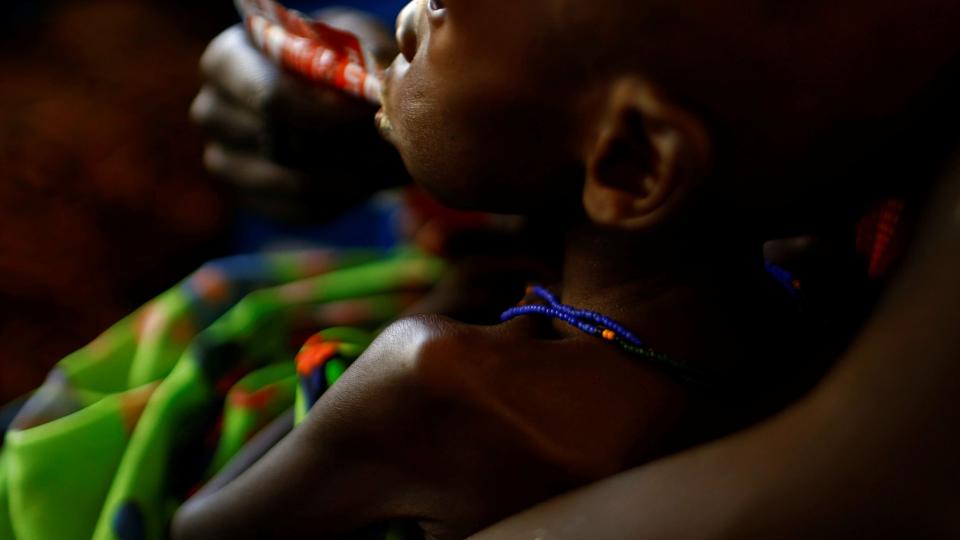 Den særlige jordnøddemos kan betyde forskellen mellem liv og død for underernærede børn. (Arkivfoto). <i>Siegfried Modola/Reuters</i>