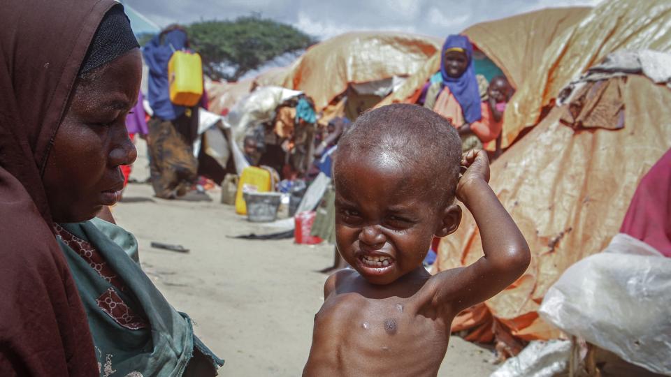 Mellem januar og juli i år er omkring 730 børn bekræftet døde på mad- og ernæringscentre på tværs af Somalia, oplyser Unicef. <i>Farah Abdi Warsameh/Ritzau Scanpix</i>