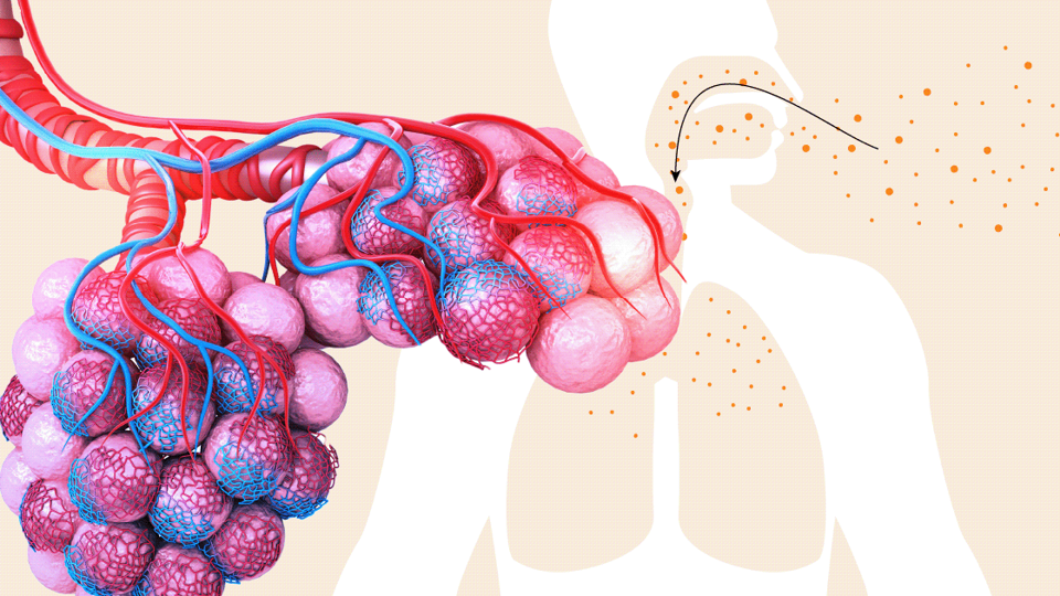 Partikler trænger ned i lungerne og kan give betændelsestilstande i de helt små blodkar. <i>Illustration: Christian Made Hagelskjær</i>