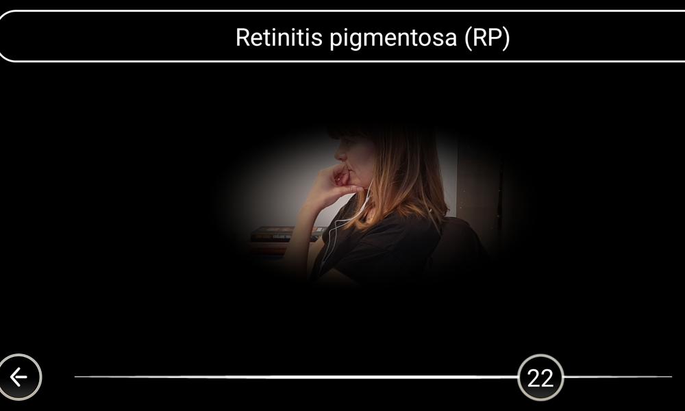 Synsimulator, retinitis pigmentosa.