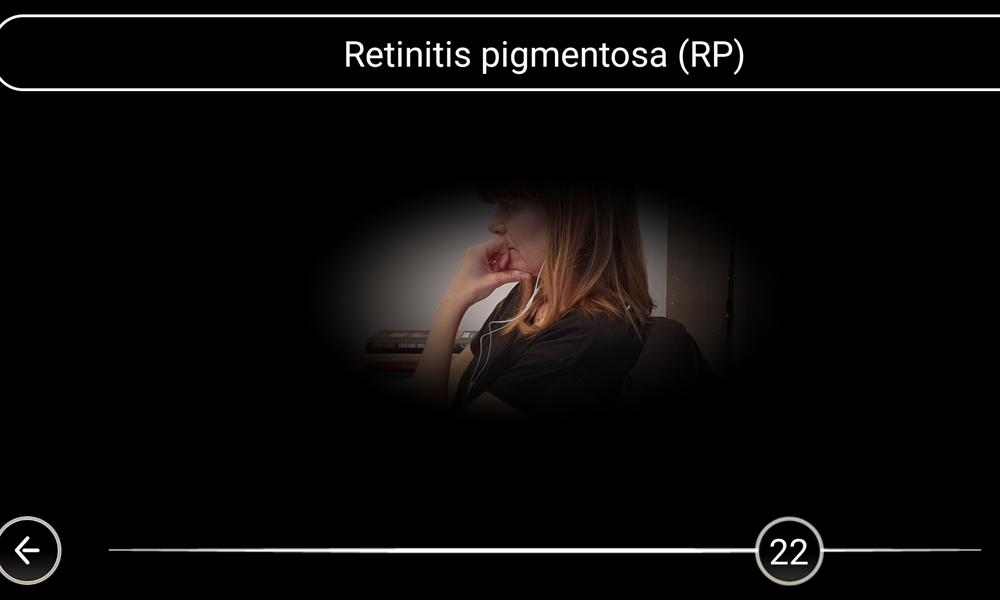 Synsimulator, retinitis pigmentosa. Synsimulator, retinitis pigmentosa.