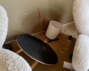 Blod på hotelværelset: Ung mand tabte kampen til fjernsynet