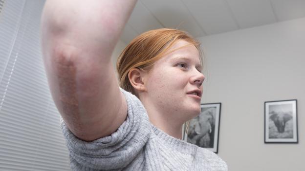Først gennemførte hun et vildt vægttab, så gennemførte hun to operationer, hvor lægerne blandt andet fjernede løs hud på overarmene. <i>Foto: Bente Poder</i>