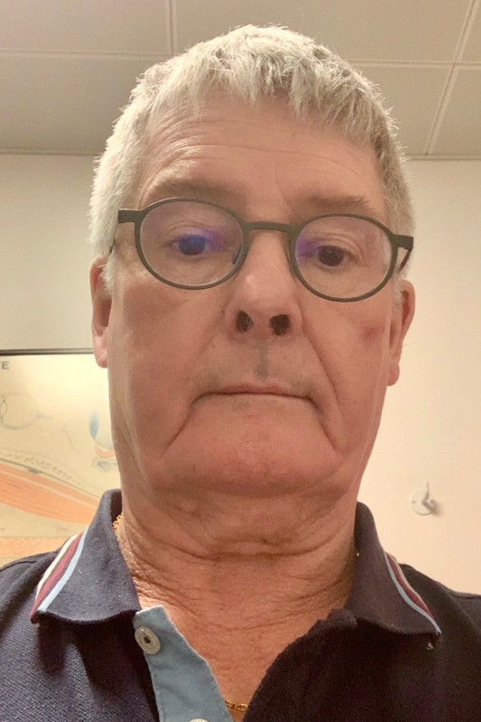 Øjenlæge Peter Jakobsen, der er pensioneret, har beholdt sit ydernummer og sin autorisation. Udover Lillelund Optik har han også aftaler med optikere i bl.a. Aalborg og Brande.